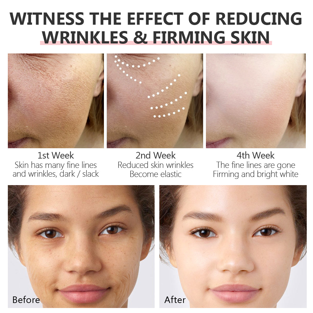 Retinol Serum for Dark Spots &amp; Wrinkles 30ml — تصویر 4